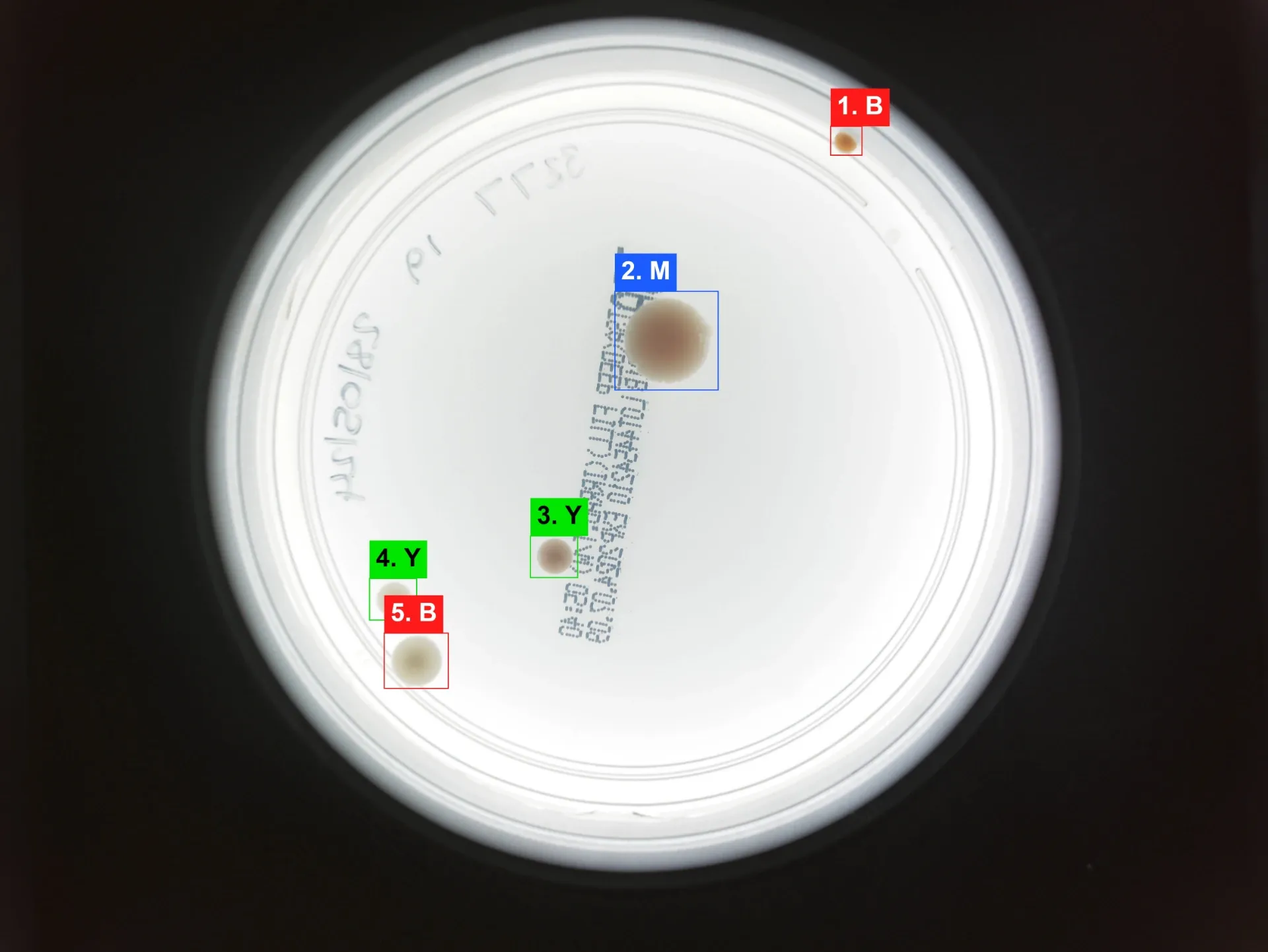 The final annotated plate: five numbered, colour-coded boxes marking bacteria, mould and yeast colonies
